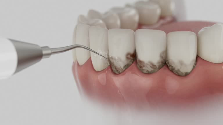 Trusted Wisdom Tooth Removal service in Big Rock, IL - Dentist Open Now